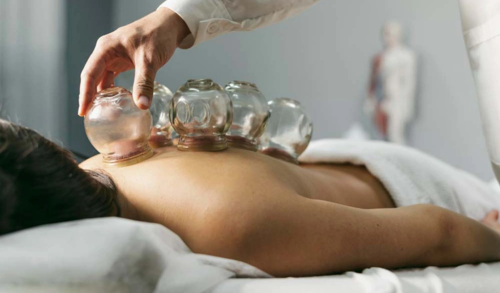 Cupping points treatment at PT of City hijama clinic in Islamabad