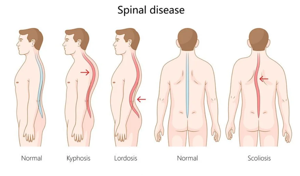 Spinal and joint alignment assessment at PT of City, Islamabad